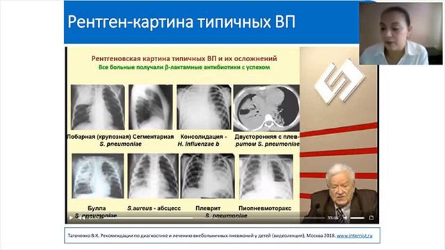 Пневмония у детей как лечить