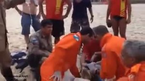 Реанимационная система (СЛР) ZOLL AutoPulse в действии