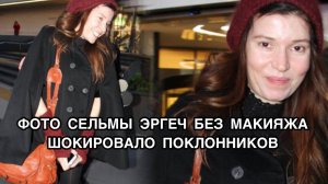 ФОТО СЕЛЬМЫ ЭРГЕЧ БЕЗ МАКИЯЖА ШОКИРОВАЛО ПОКЛОННИКОВ. Сельма Эргеч. Selma Ergeç. Турецкие актёры .