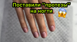Поставили ‘’протезы’’ на ногти😱
