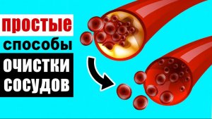 Как сосуды очищаются сами - естественным способом? И как эти механизмы можно использовать?