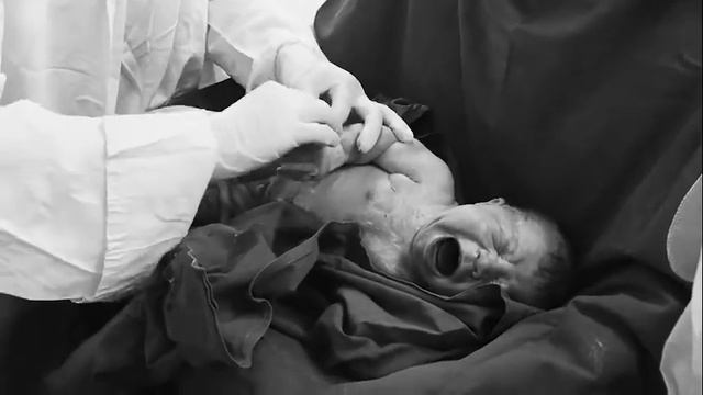 Роды! Кесарево смотреть онлайн