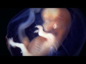 "Jag är ABORTMOTSTÅNDARE" SR P3: Fråga vad du vill