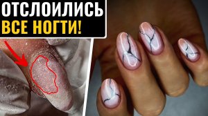 НЕ ОЖИДАЛА! ОТСЛОЙКИ на ВСЕХ НОГТЯХ под покрытием! В чем причина?