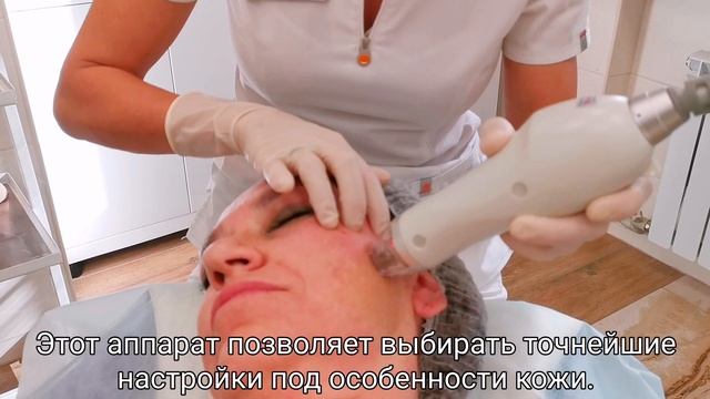 Аппаратный лифтинг Secret RF смотреть онлайн