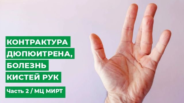 Контрактура Дюпюитрена. Контрактура Дюпюитрена лечение.