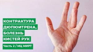 Контрактура Дюпюитрена, болезнь кистей рук. Часть 2  МЦ МИРТ.