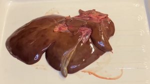 Строение печени