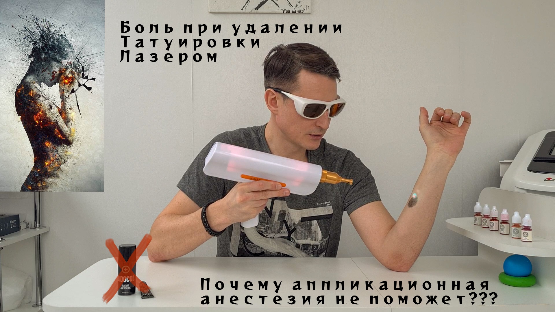 Боль при удаление татуировки лазером, от чего зависит и как с ней бороться?