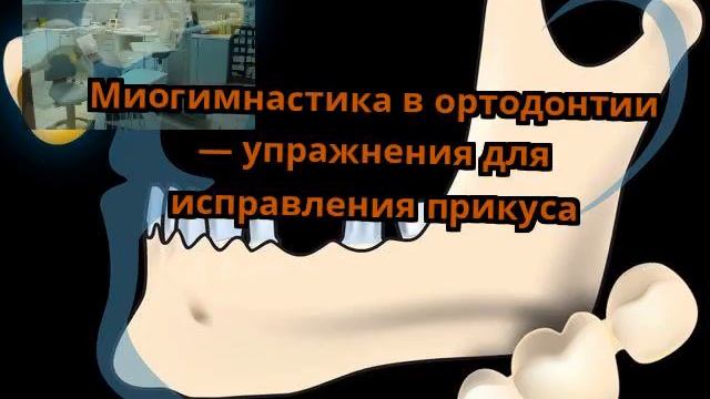 Миогимнастика в ортодонтии — упражнения для исправления прикуса