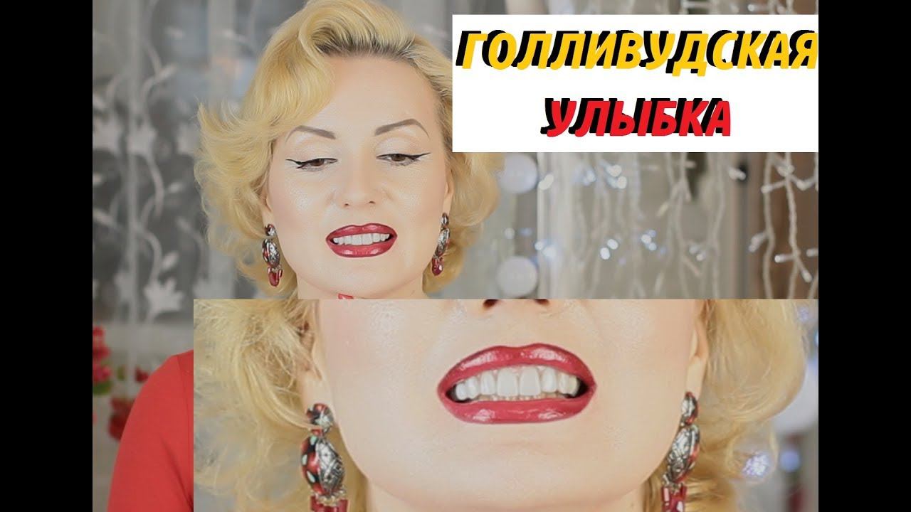 Vlog//ПОСТАВИЛА БЕЛЫЕ ВИНИРЫ//ГОЛЛИВУДСКАЯ УЛЫБКА ИЛИ УЛЫБКА НА МИЛЛИОН