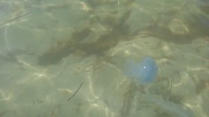 Санатории Чайка в Евпатории поселок Заозерный.