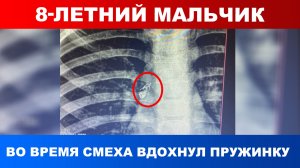 Мальчик с пружиной от ручки в дыхательных путях попал в больницу в Алматы