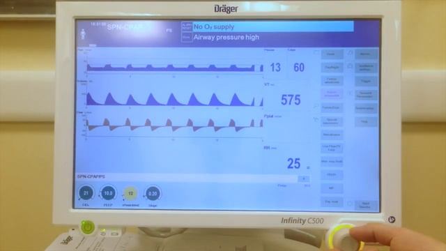 p0.1 during pressure support ventilation on a Draeger Infinity V500