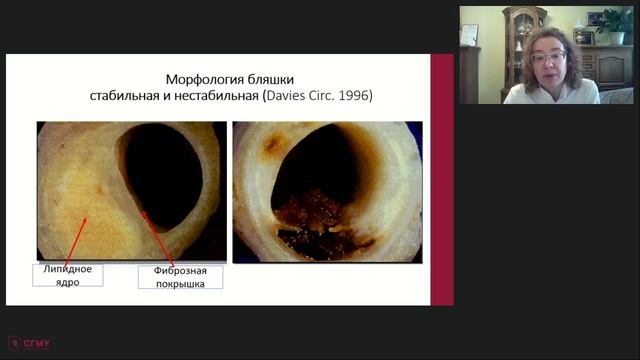 Лекция "Основы кардиологии" профессор, д.м.н. Рябова А.Ю. смотреть онлайн