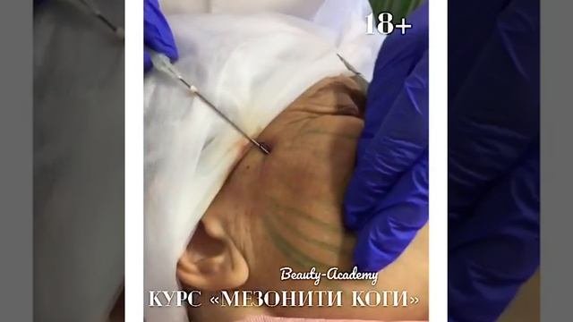 Мезонити.  Мезонити Коги.  Обучение.  Курсы