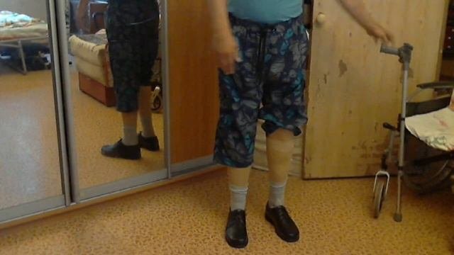 Протезы бедра и голени: на что обращать внимание, после того как Вам изготовили протезы.