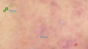 Make Your Day Relaxing with Windy Spa 6#58