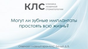 Могут ли зубные имплантаты простоять всю жизнь? Отвечает главный врач КЛС Белый Д.В.