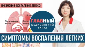 Воспаление легких: симптомы и лечение. Симптомы пневмонии у взрослых и детей