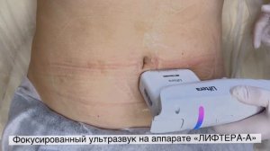 Убрать жир на животе за 30 МИНУТ!