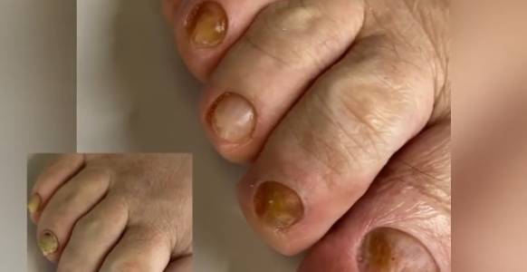 Сложная зачистка смотреть онлайн