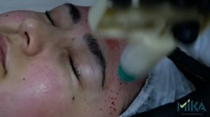 Процесс обучения по курсу "Косметологическая хиджама"