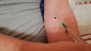 КАК СДЕЛАТЬ СЕБЕ УКОЛ В ВЕНУ