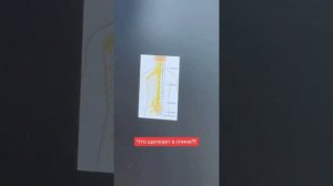 Почему хрустит позвоночник