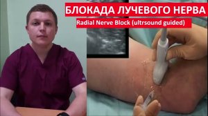 Блокада лучевого нерва УЗИ контроль Radial Nerve Block (ultrsound guided) 