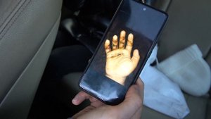 Жесткий момент из телеги Макса Ващенко что стало с рукой Антона? ?