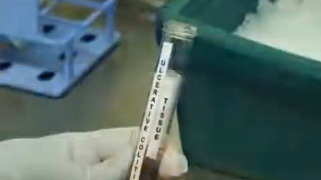 CD 90+ Fibroblast isolation from GIT specimens | Protocol Preview смотреть онлайн