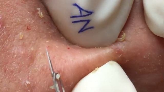 Most Satisfying and Relaxation with An Spa Video #874