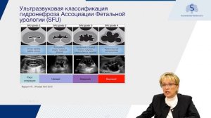 Врожденный гидронефроз у детей