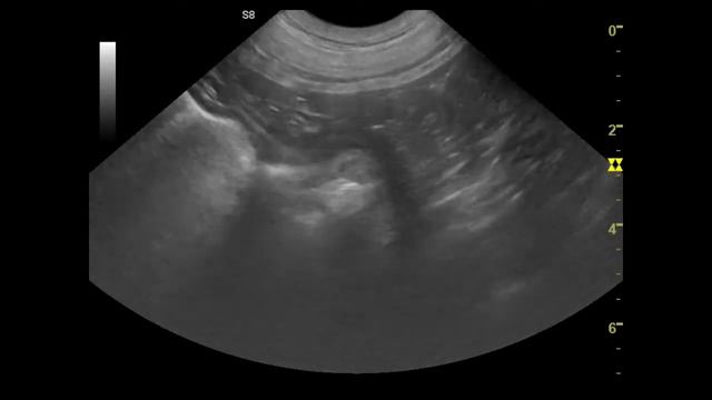 Инородные тела в тощей кишке и в желудке у собаки на УЗИ смотреть онлайн