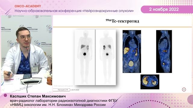 Радионуклидная диагностика НЭО. Каспшик С. М. смотреть онлайн