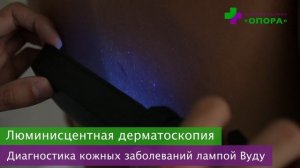 Люминисцентная дерматоскопия