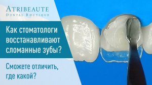 ♀️ Как стоматологи восстанавливают сломанные зубы. Сможете отличить, где какой?