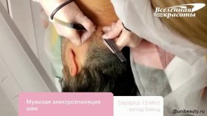 Мужская электроэпиляция шеи методом blend