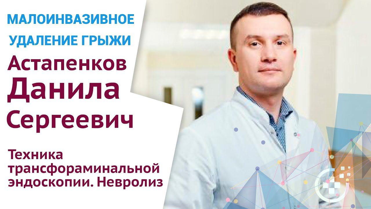 Техника трансфораминальной эндоскопии  Невролиз смотреть онлайн