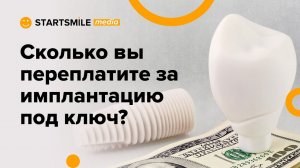 Имплантация зубов под ключ | В чем подвох?