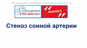 Стеноз сонных артерий
