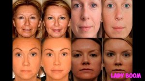 Супер Крем для ЛИЦА от МОРЩИН и Расширенных пор! Как убрать морщины в домашних условиях?