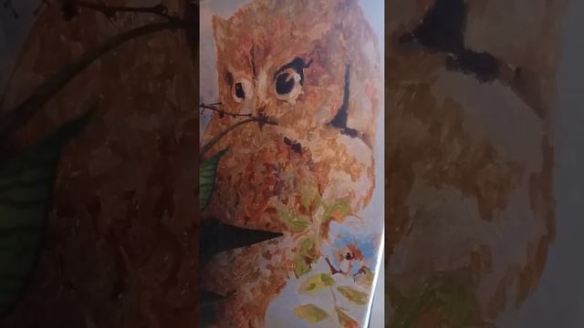 Аутоиммунный тиреоидит.Гипотериоз.