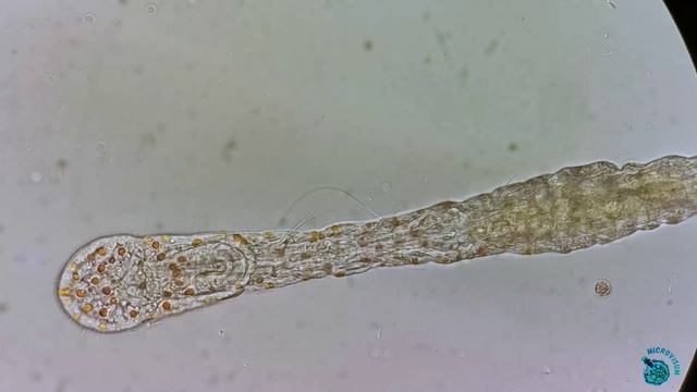 Голодный червь Aelosoma
