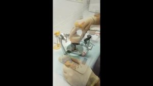 Гипсовка моделей в артикуллятор.
