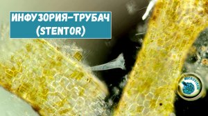 Инфузория трубач (Stentor)