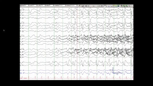 10 Diffuse Slow and PDs смотреть онлайн