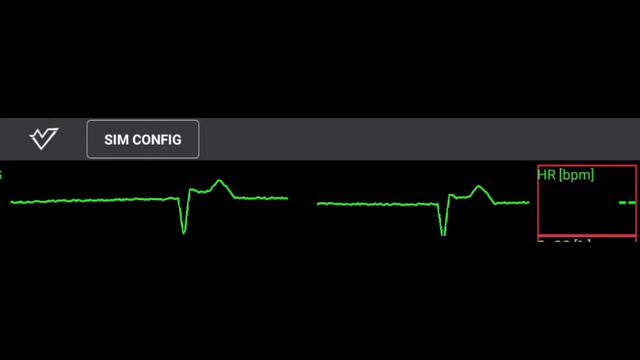 Экг патологии смотреть онлайн
