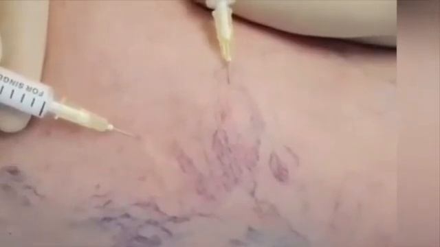 Центр косметологии «Tulip Medicine» смотреть онлайн